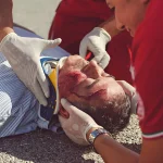 What Qualifies As A Catastrophic Injury?